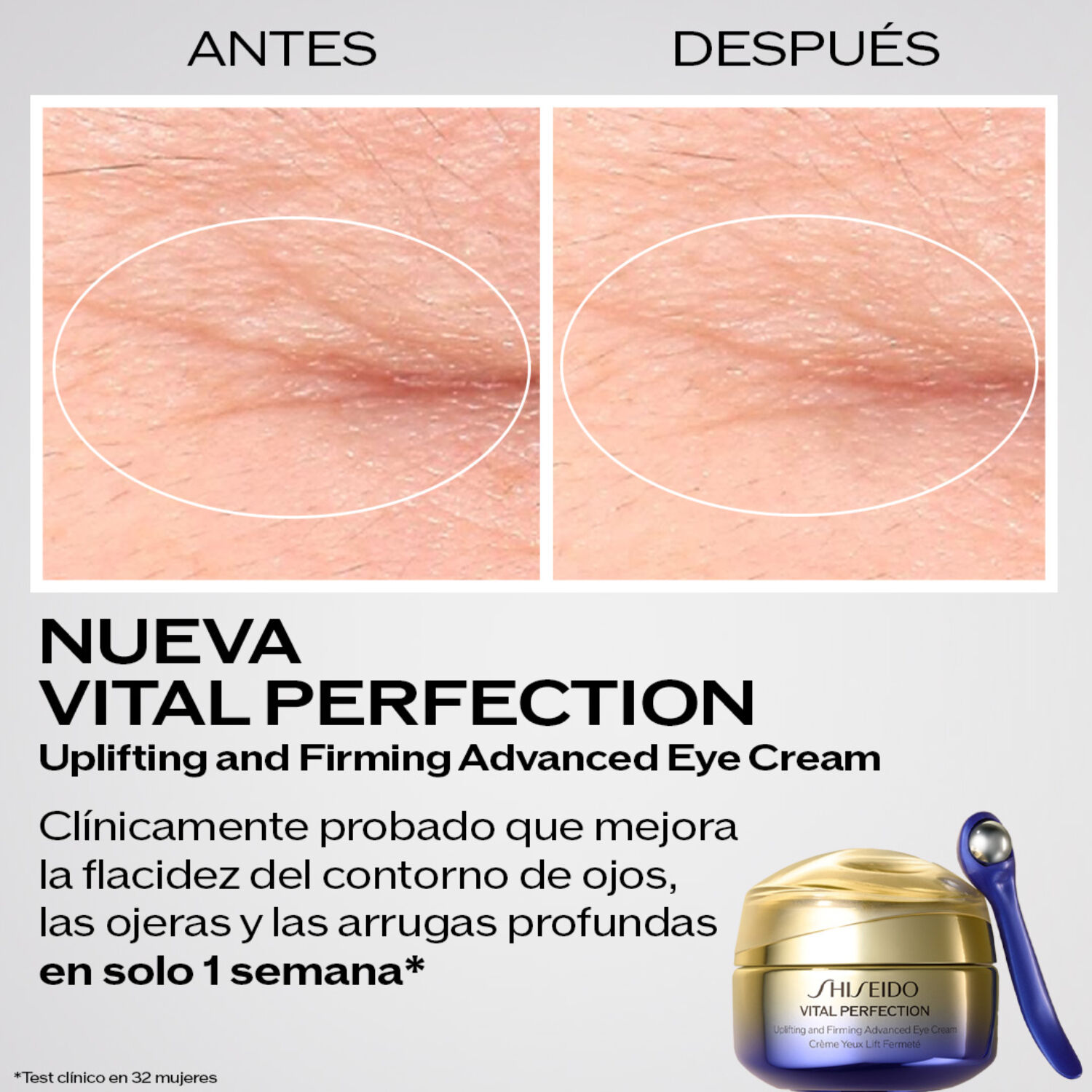 Shiseido | SHISEIDO - Vital Perfection Eye Cream - 15ml
